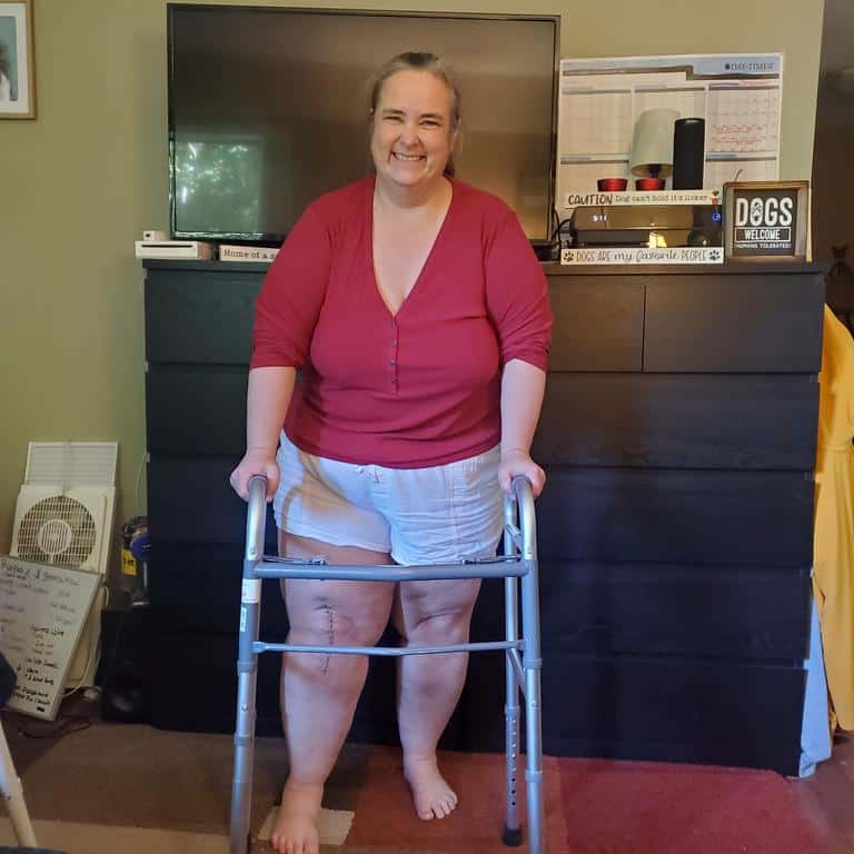 Standing with a walker after my knee replacement surgery.